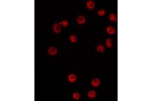 ABIN6266525 staining Hela by IF/ICC. (Cyclin G1 抗体  (Internal Region))