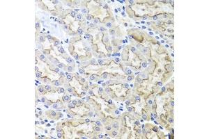 Immunohistochemistry of paraffin-embedded rat kidney using LRP2 antibody (ABIN1680712, ABIN3017881, ABIN3017882 and ABIN6220293) at dilution of 1:100 (40x lens). (LRP2 抗体  (AA 4446-4655))