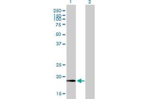 Western Blot analysis of CETN2 expression in transfected 293T cell line by CETN2 MaxPab polyclonal antibody. (CETN2 抗体  (AA 1-172))