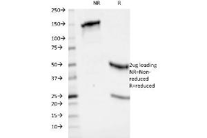 SDS-PAGE Analysis Purified HLA-ABC Mouse Monoclonal Antibody (246-B8. (HLA-ABC 抗体)