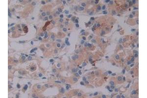 DAB staining on IHC-P; Samples: Human Stomach Tissue (LTBP2 抗体  (AA 522-814))