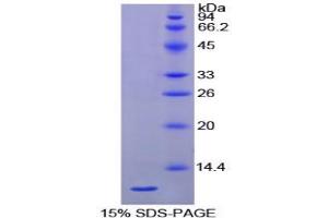 SDS-PAGE analysis of Chicken HSPA8 Protein. (Hsc70 蛋白)