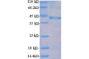 SDS-PAGE (SDS) image for Follicle Stimulating Hormone Receptor (FSHR) (AA 18-366), (Extracellular) protein (His tag) (ABIN5709537)