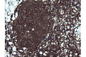 Image no. 2 for anti-V-Ets Erythroblastosis Virus E26 Oncogene Homolog 2 (ETS2) (AA 90-349) antibody (ABIN1491703) (ETS2 抗体  (AA 90-349))