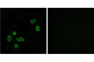 Immunofluorescence analysis of A549 cells, using BRP44L antibody. (BRP44L 抗体)