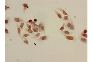Immunocytochemistry analysis of Hela cells using ABIN7139204 at dilution of 1:100 (HIST1H3A 抗体  (acLys9))