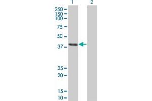 Western Blot analysis of CLN3 expression in transfected 293T cell line by CLN3 monoclonal antibody (M03), clone 1G10. (CLN3 抗体  (AA 1-438))
