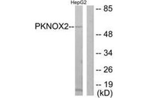 Western blot analysis of extracts from HepG2 cells, using PKNOX2 Antibody. (PKNOX2 抗体  (AA 341-390))