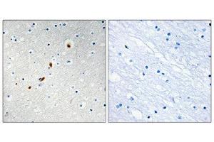 Immunohistochemistry (IHC) image for anti-Zinc Finger Protein 596 (ZNF596) (Internal Region) antibody (ABIN1849812) (ZNF596 抗体  (Internal Region))