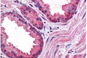 Human Prostate: Formalin-Fixed, Paraffin-Embedded (FFPE) (CCNDBP1 抗体  (AA 348-360))