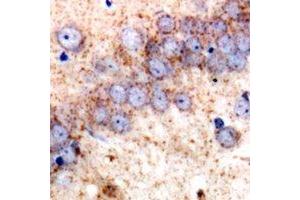 Immunohistochemistry (IHC) image for anti-TNF Receptor-Associated Protein 1 (TRAP1) antibody (ABIN7308438) (TRAP1 抗体)