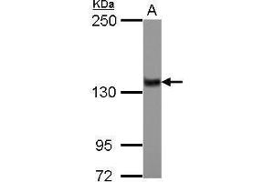 WB Image Sample (30 ug of whole cell lysate) A: IMR32 5% SDS PAGE antibody diluted at 1:1000 (ZNF217 抗体)