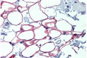 Adipocytes, Human: Formalin-Fixed, Paraffin-Embedded (FFPE) (NFIC 抗体  (AA 323-372))