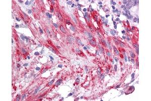 Immunohistochemistry (IHC) image for anti-Sirtuin 5 (SIRT5) (Middle Region) antibody (ABIN405300) (SIRT5 抗体  (Middle Region))