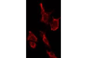 ABIN6275173 staining LOVO cells by IF/ICC. (SAR1B 抗体  (Internal Region))
