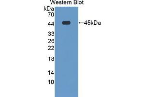 Detection of Recombinant CRY1, Human using Polyclonal Antibody to Cryptochrome 1 (CRY1)
