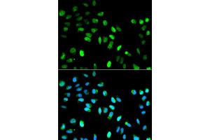 Immunofluorescence analysis of HeLa cell using MAD1L1 antibody. (MAD1L1 抗体)