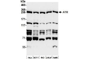 anti-ATR serine/threonine kinase (ATR) (AA 1675-1725) antibody