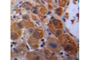 Used in DAB staining on fromalin fixed paraffin-embedded Liver tissue (KNG1 抗体  (AA 22-379))