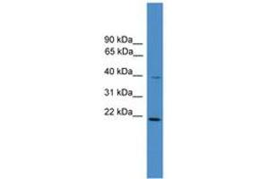 anti-DnaJ (Hsp40) Homolog, Subfamily B, Member 4 (DNAJB4) (AA 210-259) antibody
