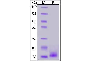 Cynomolgus / Rhesus macaque BCMA, His Tag on  under reducing (R) condition.