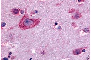 Anti-Delta Opioid Receptor antibody  ABIN1048497 IHC staining of human brain, neurons and glia. (OPRD1 抗体  (C-Term))