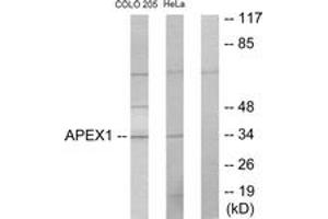 Western blot analysis of extracts from COLO205/HeLa cells, using APEX1 Antibody. (APEX1 抗体  (AA 191-240))