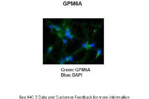 Primary Antibody Dilution: 1:250Secondary Antibody: Anti-rabbit-AlexaFluor 488 Secondary Antibody Dilution: 1:5000Color/Signal Descriptions: GPM6A: Green DAPI: Blue  Gene Name: GPM6A Submitted by: Anonymous (GPM6A 抗体  (C-Term))