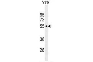 CCDC97 Antibody (C-term) western blot analysis in Y79 cell line lysates (35µg/lane). (CCDC97 抗体  (C-Term))