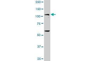PKN1 MaxPab rabbit polyclonal antibody. (PKN1 抗体  (AA 1-942))