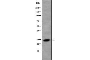Western blot analysis of CREG1 using K562 whole cell lysates (CREG1 抗体  (C-Term))