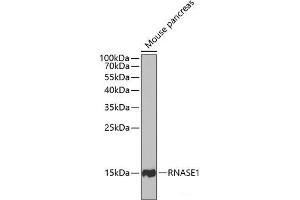 Western blot analysis of extracts of Mouse pancreas using RNASE1 Polyclonal Antibody at dilution of 1:1000. (RNASE1 抗体)