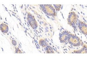 Immunohistochemistry (IHC) image for anti-ADAM Metallopeptidase Domain 12 (ADAM12) (AA 513-767) antibody (ABIN7436780)