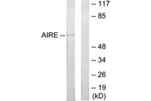 Western blot analysis of extracts from 293 cells, using AIRE Antibody. (AIRE 抗体  (AA 91-140))
