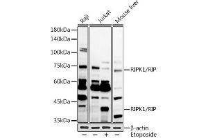 Western blot analysis of extracts of various cell lines, using RIPK1/RIP antibody (ABIN6132596, ABIN6146959, ABIN6146960 and ABIN6223282) at 1:1000 dilution. (RIPK1 抗体  (AA 170-440))
