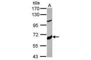 Image no. 1 for anti-Cytochrome P450, Family 17, Subfamily A, Polypeptide 1 (CYP17A1) (AA 13-366) antibody (ABIN1497707) (CYP17A1 抗体  (AA 13-366))