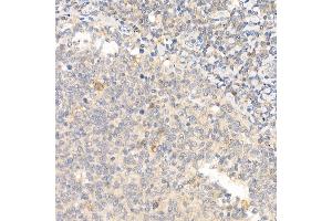 Immunohistochemistry of paraffin-embedded human tonsil using IL21 Rabbit pAb (ABIN6128086, ABIN6142359, ABIN6142360 and ABIN6223071) at dilution of 1:50 (40x lens). (IL-21 抗体  (AA 25-162))