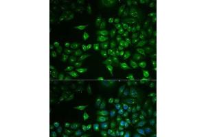 Immunofluorescence analysis of MCF7 cells using PLA2G2D Polyclonal Antibody