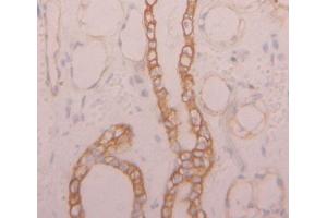 IHC-P analysis of Kidney tissue, with DAB staining. (NKp44/NCR2 抗体  (AA 22-120))