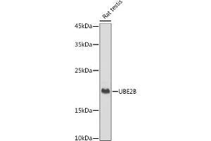 Western blot analysis of extracts of Rat testis, using UBE2B antibody (ABIN7271173) at 1:1000 dilution. (UBE2B 抗体)