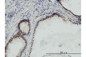 Immunoperoxidase of monoclonal antibody to RPA3 on formalin-fixed paraffin-embedded human prostate. (RPA3 抗体  (AA 12-121))