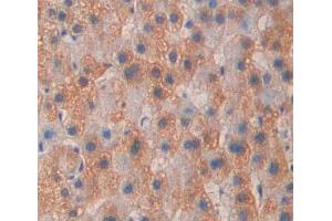 Used in DAB staining on fromalin fixed paraffin- embedded liver tissue (PTPN21 抗体  (AA 981-1174))
