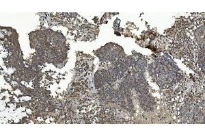 IHC analysis of ERK5/MAPK7 using anti-ERK5/MAPK7 antibody (ABIN7600701). (MAPK7 抗体  (AA 22-816))