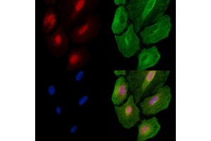 ABIN6260038 and ABIN6278666 staining  cells by IF/ICC. (ARID1A 抗体  (Internal Region))