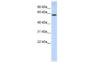 Western Blotting (WB) image for anti-Tripartite Motif Containing 55 (TRIM55) antibody (ABIN2458740) (TRIM55 抗体)