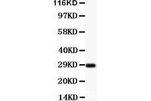 Anti-BDNF Picoband antibody,  All lanes: Anti-BDNF at 0. (BDNF 抗体  (AA 129-247))