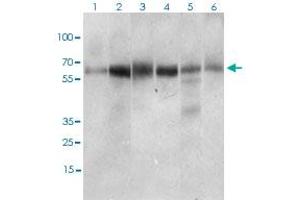 Western blot analysis of Lane 1: Hela cell lysate; Lane 2: Jurkat cell lysate; Lane 3: HEK293 cell lysate; Lane 4: A431 cell lysate; Lane 5: HepG2 cell lysate; Lane 6: RAJI cell lysate with CTNNBL1 monoclonal antibody, clone 1E4F5  at 1:500-1:2000 dilution. (CTNNBL1 抗体  (AA 390-557))