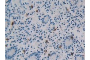 Detection of REG3g in Human Stomach Tissue using Polyclonal Antibody to Regenerating Islet Derived Protein 3 Gamma (REG3g) (REG3g 抗体  (AA 39-175))