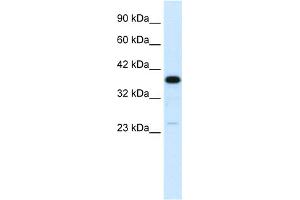WB Suggested Anti-C4BPB Antibody Titration:  0. (C4BPB 抗体  (N-Term))