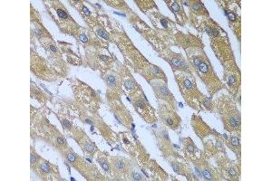 Immunohistochemistry of paraffin-embedded Human liver using CAD Polyclonal Antibody at dilution of 1:100 (40x lens). (CAD 抗体)